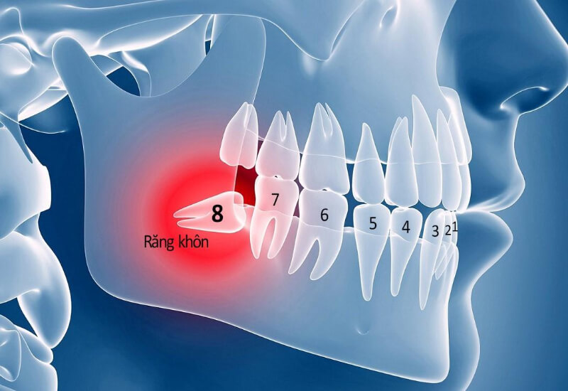 Răng số 8 thường mọc ở cuối cùng của cung hàm